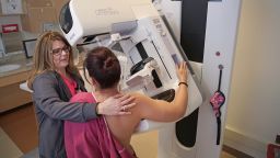 Katherine Esdale, a breast imaging technologist at the Helen F. Graham Center, conducts a 3-D mammogram using a tomosynthesis machine made by Hologic. The machine's core technology is made at Hologic's plant near Glasgow.
Katherine Esdale, a breast imaging technologist at the Helen F. Graham Center, conducts a 3-D mammogram in February using a tomosynthesis machine made by Hologic. The machine's core technology is made at Hologic's plant near Glasgow, Del.