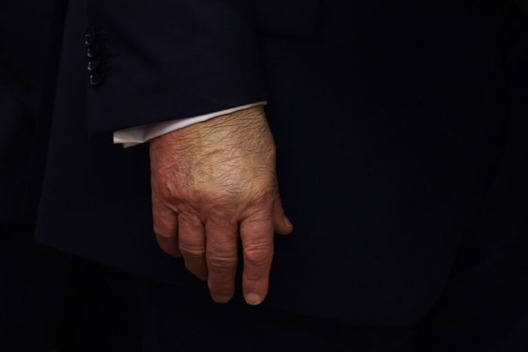 President Donald Trump's hand on September 2, 2025 in Washington, DC.