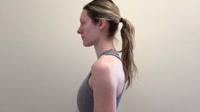 Woman standing with poor posture