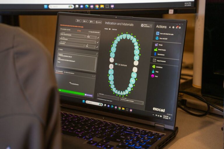 Gibson self-taught himself about 3D printing. When a patient's images are uploaded into a computer file, he can send them to the 3D printer to make dentures that fit each individual patient.