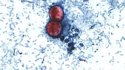 Cyclosporiasis is an intestinal infection caused by the cyclospora cayetanensis parasite. It's seen here on a stool sample through a microscope on a slide. The parasite is too small to see without the use of a microscope. Illness is caused by consuming food or drink that contains the parasite and usually takes about a week to make a person sick.