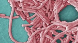 What is Legionnaires Disease?_00001608.jpg