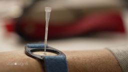 <p> Researchers have discovered biomarkers in sweat that could play a role advancing everything from precision medicine and nutrition to diagnosing things like depression and anxiety.</p>