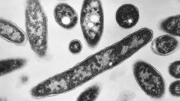 This 1978 electron microscope image made available by the Centers for Disease Control and Prevention shows Legionella pneumophila bacteria which are responsible for causing the pneumonic disease Legionnaires' disease.