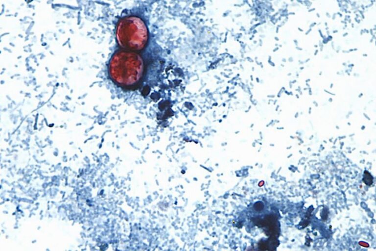 The test for cyclospora involves having a stool sample evaluated at a lab.
