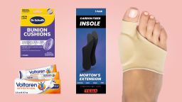 Bunions.jpg