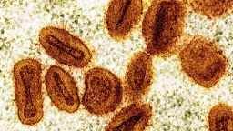 This colorized electron microscope image provided by the National Institute of Allergy and Infectious Diseases in 2024 shows Mpox virus particles, orange, found within infected cells, green.