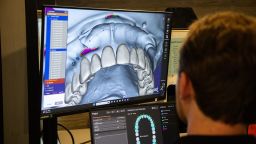 Connor Gibson is a 22-year-old engineer at Remote Area Medical (RAM), a large nonprofit provider of free dental, vision and medical care to America’s most vulnerable population. He taught himself how to design dentures on his computer, then print them on 3D printers. <strong>Click to learn more.</strong>