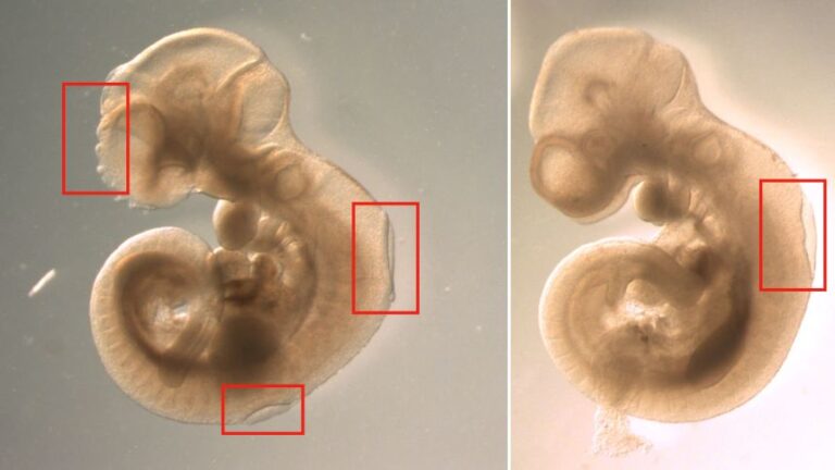 Two mice fetuses are seen side by side with open spinal columns after exposure to QACs. One fetus (left) also has a severe facial deformity.