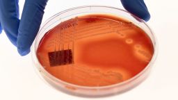 Jean Lee, a PhD student at Melbourne's Doherty Institute, displays the superbug Staphylcocus epidermidis on an agar plate in Melbourne on September 4, 2018. - A superbug resistant to all known antibiotics that can cause