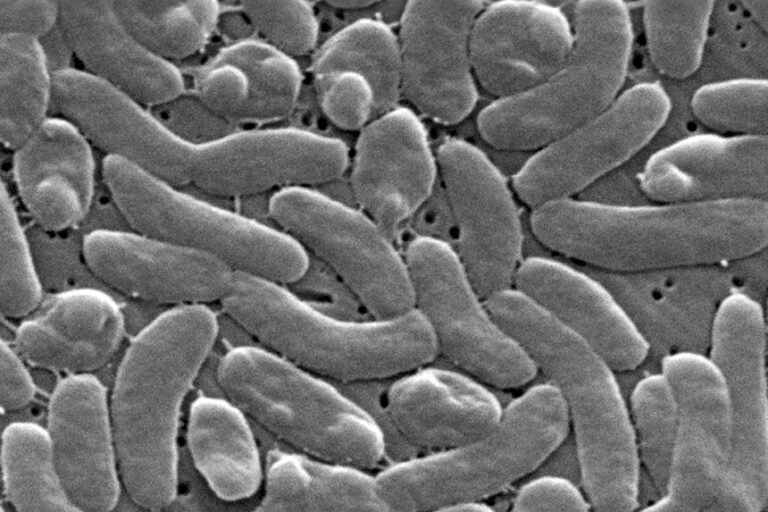This 2005 electron microscope image provided by the Centers for Disease Control and Prevention shows Vibrio vulnificus bacteria.