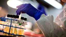 Microbiologist Tatiana Travis works with tubes of bacteria samples in an antimicrobial resistance and characterization lab within the Infectious Disease Laboratory at the federal Centers for Disease Control and Prevention, Monday, Nov. 25, 2013, in Atlanta.