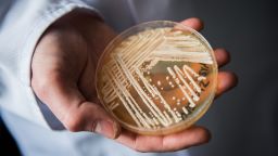 The director of the National Reference Centre for Invasive Fungus Infections, Oliver Kurzai, holding in his hands a petri dish holding the yeast candida auris in a laboratory of Wuerzburg University in Wuerzburg, Germany, 23 January 2018. There has been a recent rise of cases in Germany of seriously ill patients becoming infected with the dangerous yeast candida auris. Photo: Nicolas Armer/dpa (Photo by Nicolas Armer/picture alliance via Getty Images)