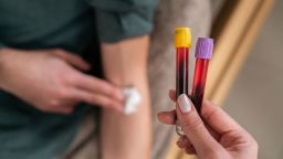 The female nurse takes blood from a patient.