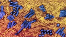 Colorized transmission electron micrograph of rabies virus particles (blue).