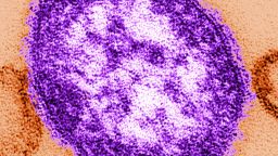 Thin-section transmission electron micrograph, TEM, of a single measles virus particle or virion