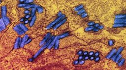 Colorized transmission electron micrograph of rabies virus particles, seen in blue.