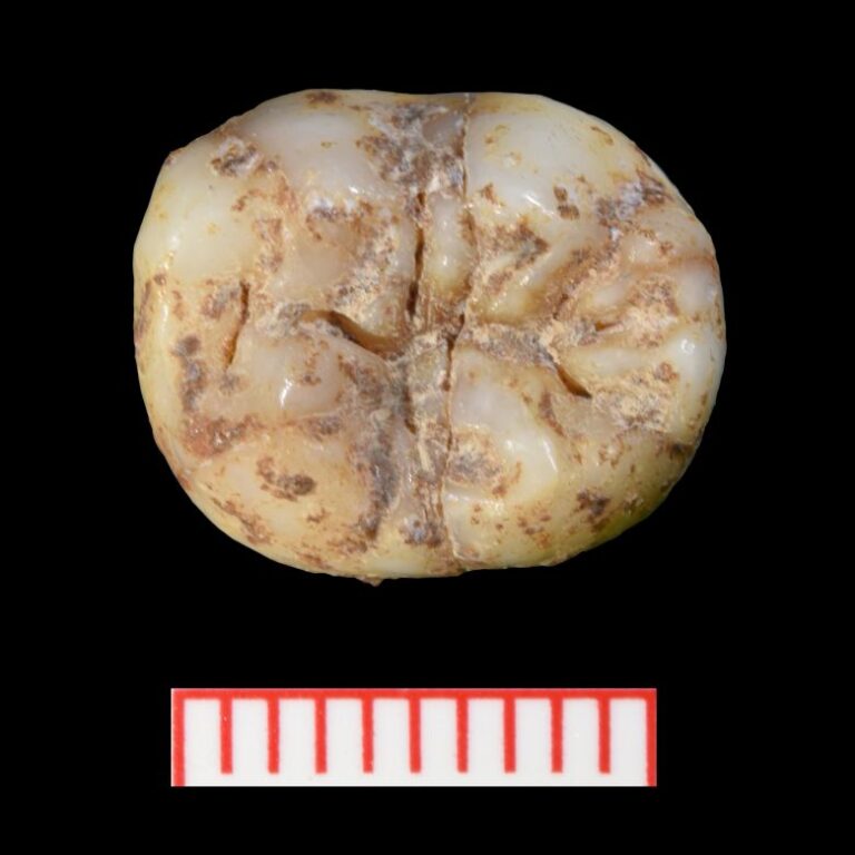 Denisovan teeth have grooves and crests that are unique to the species.
