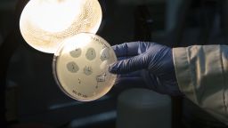 A technician holds an agar plate containing bacteriophage at a GangaGen Inc. laboratory in Bengaluru, India, on Wednesday, May 30, 2018.