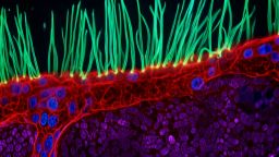 Thumbnail - Nikon Small World Comp digvid 1.jpg
