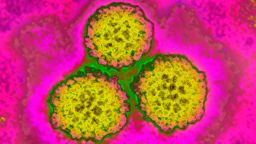 Papilloma virus, HPV). It causes cervical cancer. Image taken with transmission electron microscopy. (Photo by: BSIP/Universal Images Group via Getty Images)