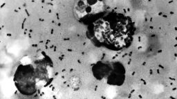A bubonic plague smear, prepared from a lymph removed from an adenopathic lymph node of a plague patient, demonstrates the presence of the Yersinia pestis bacteria that causes the plague, in this undated photo.
